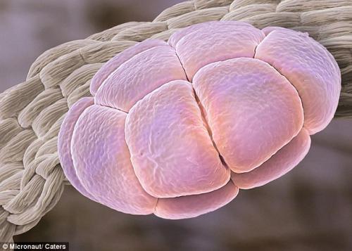Возбудители сенной лихорадки попали под микроскоп