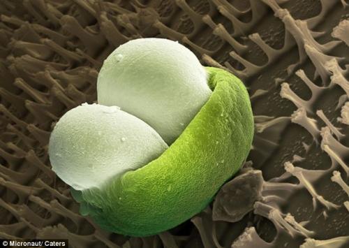 Возбудители сенной лихорадки попали под микроскоп