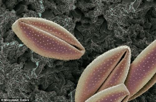 Возбудители сенной лихорадки попали под микроскоп