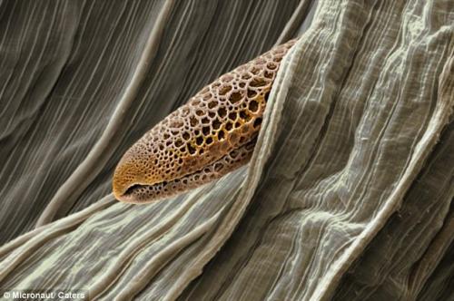 Возбудители сенной лихорадки попали под микроскоп