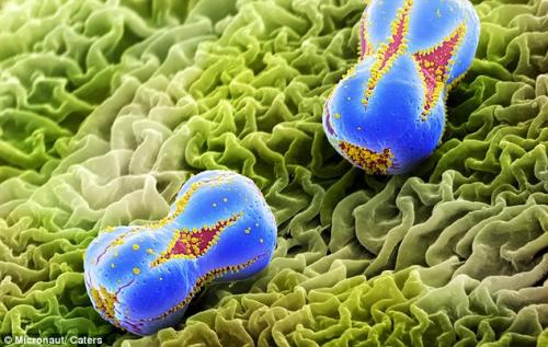 Возбудители сенной лихорадки попали под микроскоп