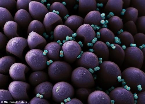 Возбудители сенной лихорадки попали под микроскоп