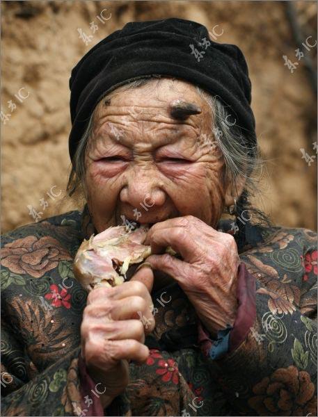 У 101-летней китаянки вырос рог