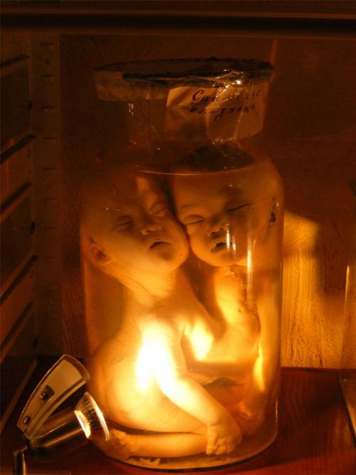 В «кабинете радости» показывают младенцев в банках