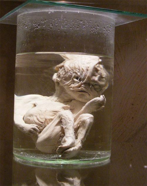 В «кабинете радости» показывают младенцев в банках