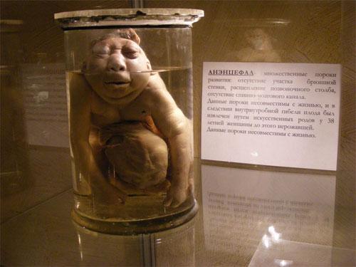 В «кабинете радости» показывают младенцев в банках