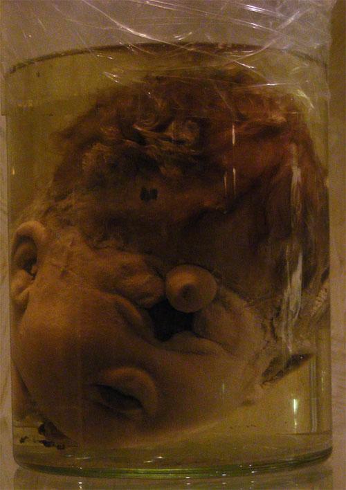 В «кабинете радости» показывают младенцев в банках