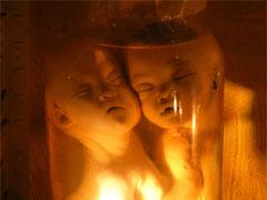 В «кабинете радости» показывают младенцев в банках