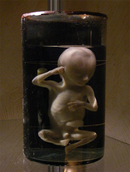 В «кабинете радости» показывают младенцев в банках