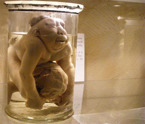 В «кабинете радости» показывают младенцев в банках