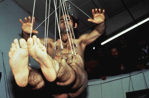 Человек, который вживил ухо в собственную руку