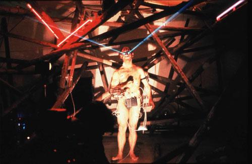 Человек, который вживил ухо в собственную руку