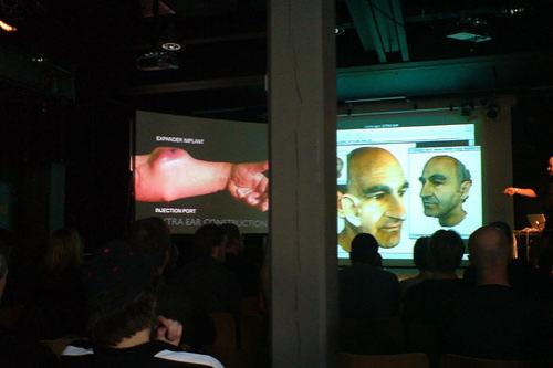 Человек, который вживил ухо в собственную руку