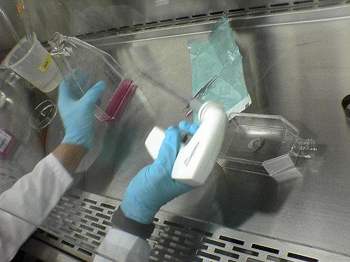 Человек, который вживил ухо в собственную руку