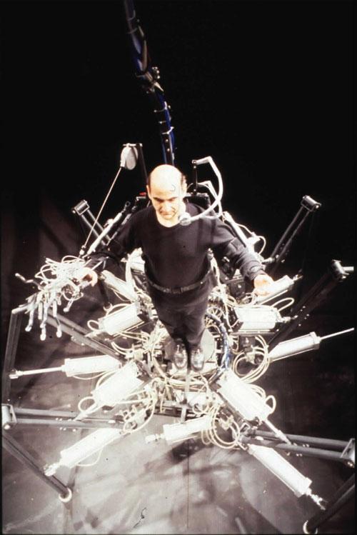 Человек, который вживил ухо в собственную руку