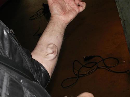 Человек, который вживил ухо в собственную руку