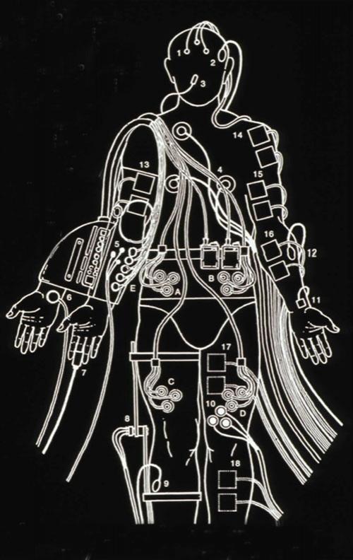 Человек, который вживил ухо в собственную руку