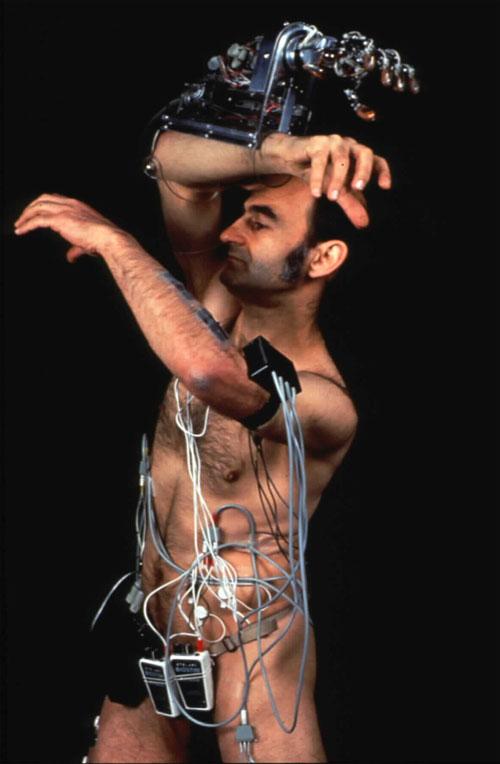 Человек, который вживил ухо в собственную руку