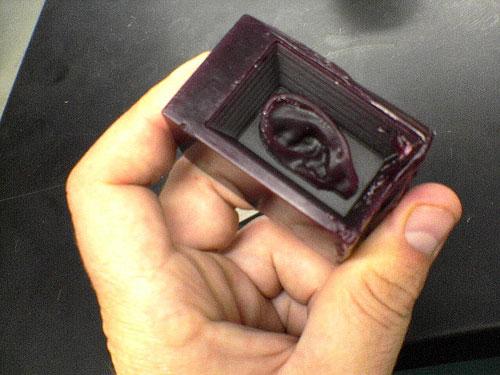 Человек, который вживил ухо в собственную руку