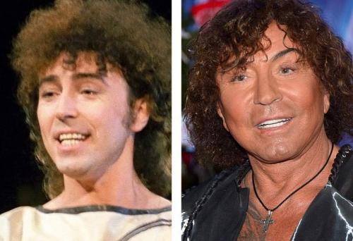 Российские звезды, переборщившие с пластикой