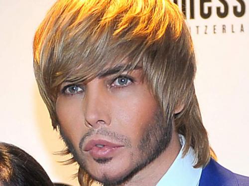 Российские звезды, переборщившие с пластикой