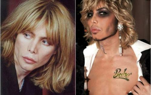 Российские звезды, переборщившие с пластикой