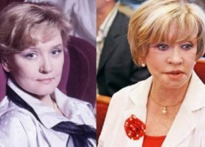 Российские звезды, переборщившие с пластикой