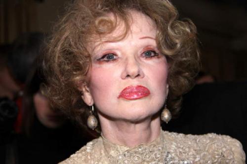 Российские звезды, переборщившие с пластикой