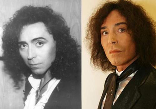 Российские звезды, переборщившие с пластикой