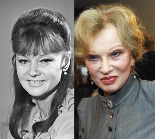 Российские звезды, переборщившие с пластикой