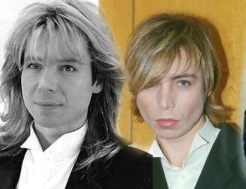 Российские звезды, переборщившие с пластикой