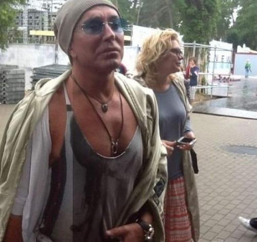 Российские звезды, переборщившие с пластикой