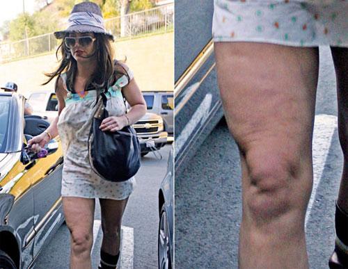 Звездные изъяны: предательские части тела