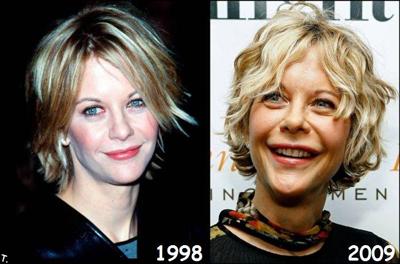 Звезды сейчас и …дцать лет назад