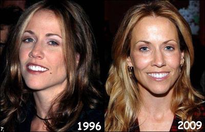 Звезды сейчас и …дцать лет назад