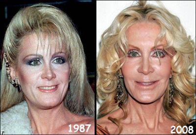 Звезды сейчас и …дцать лет назад