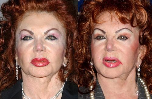 Звезды, проводившие чудовищные эксперименты со своей внешностью