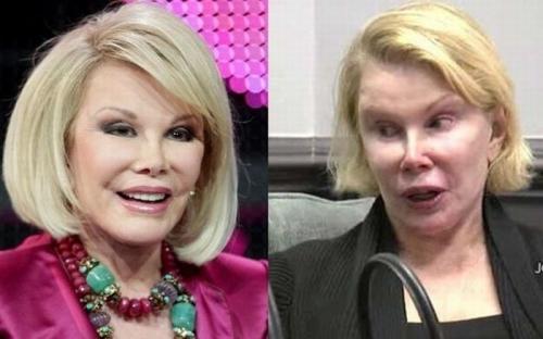 Звезды, проводившие чудовищные эксперименты со своей внешностью