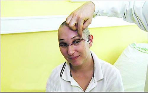 Самые невероятные операции на голове человека