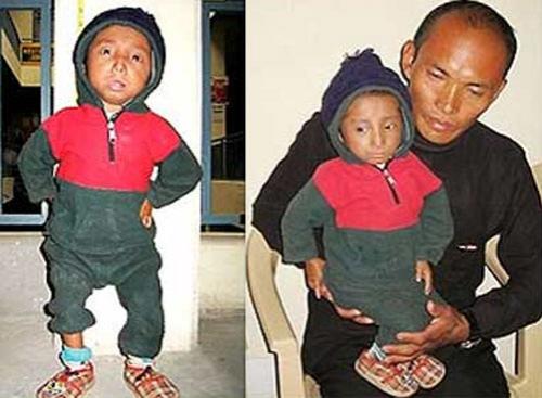 Самый высокий человек на земле встретился с самым маленьким