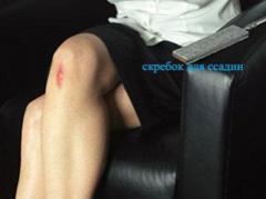 Набор "Казанова": укусы и ссадины как настоящие!