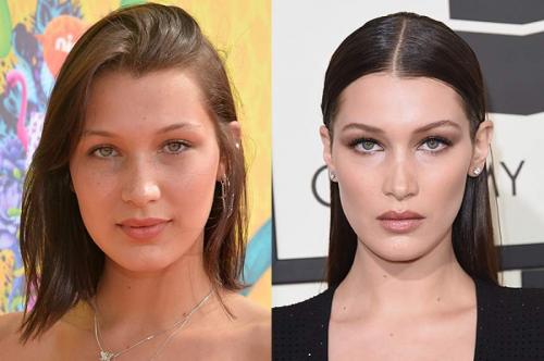 Известные люди с серьезными заболеваниями