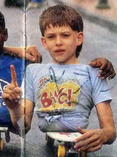 Человек с половиной тела показал миру, как жить