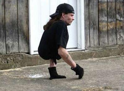 Человек с половиной тела показал миру, как жить