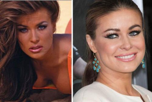 Знаменитости 90-х: тогда и сейчас