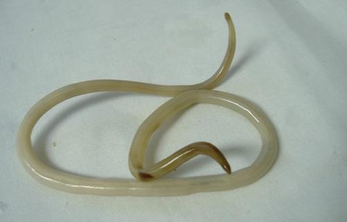 10 самых страшных паразитов, которые могут жить в человеческом теле