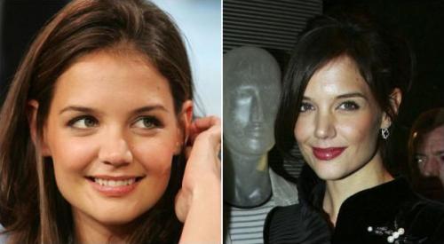 Пластические операции звезд: до и после