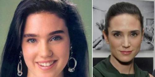 Пластические операции звезд: до и после