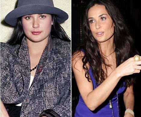 Пластические операции звезд: до и после