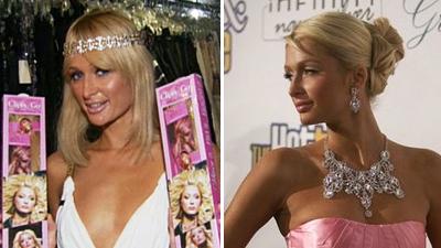 Пластические операции звезд: до и после